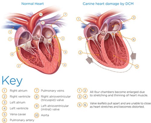 dcm normal heart